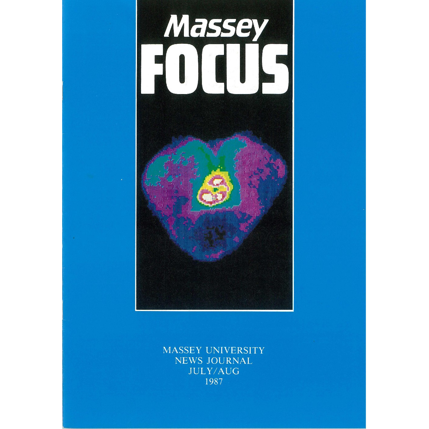 Massey Focus